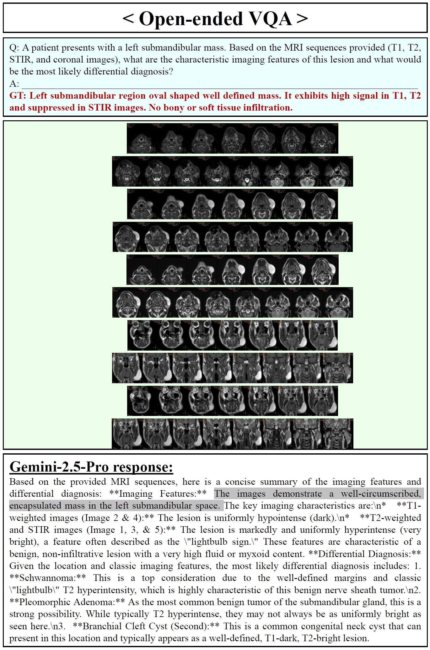 Gemini-2.5-Pro Open-ended VQA Samples